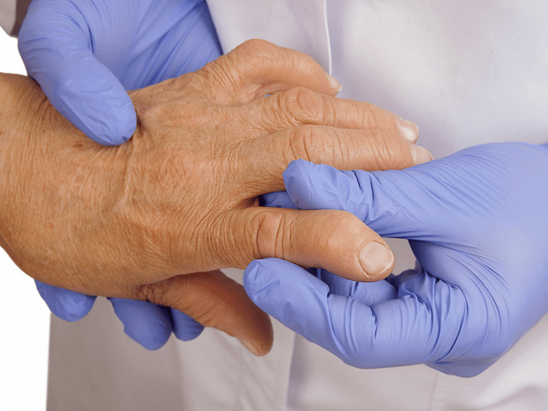 lékař zkoumá ruku na bolest v kloubech prstů